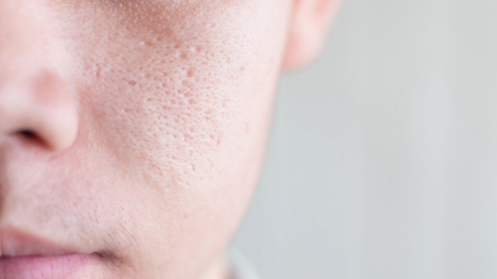 cara mengecilkan pori pori wajah yang paling mudah
