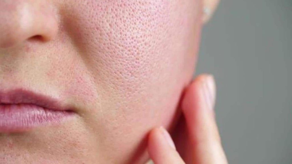kandungan skincare untuk mengecilkan pori pori review rojukiss mask penyebab pori pori besar