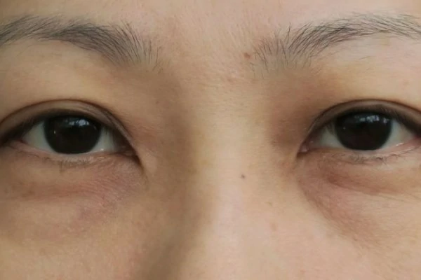 kandungan eye cream artikel mata 9